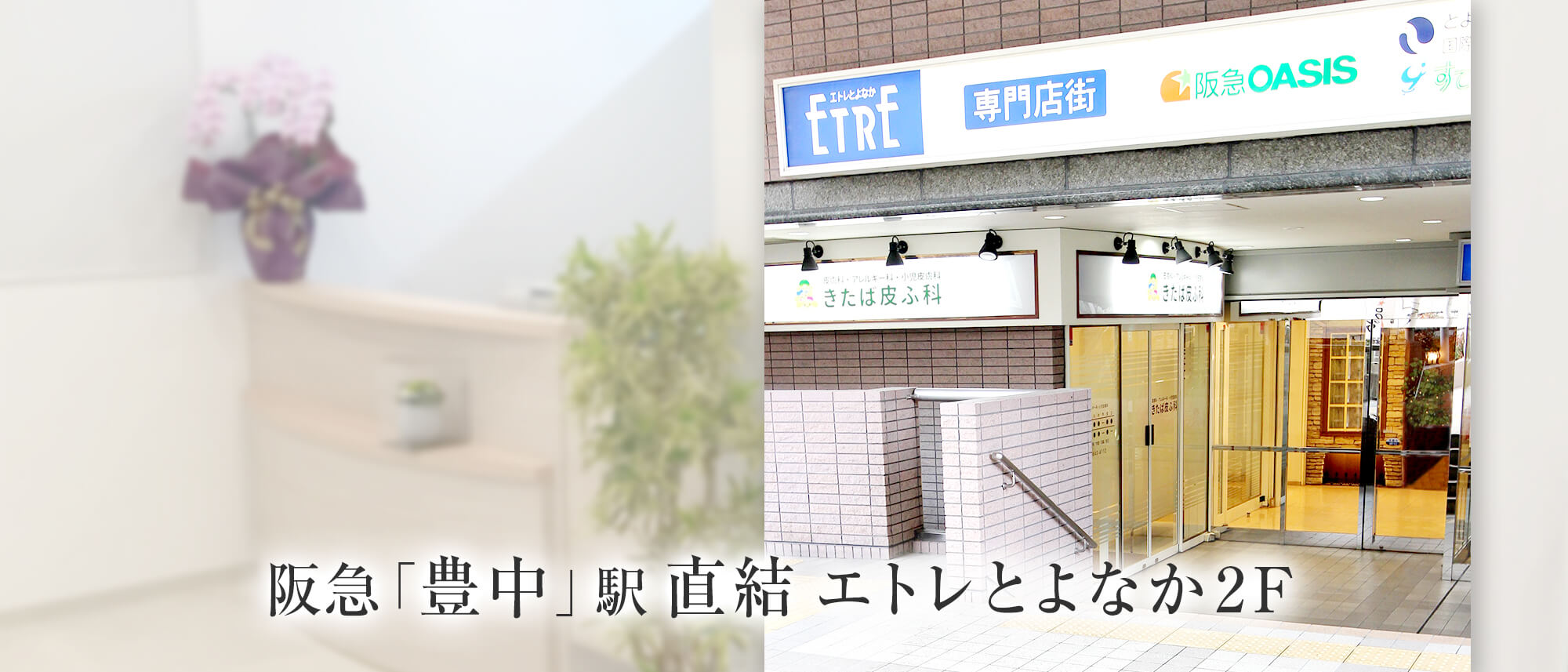 阪急「豊中」駅直結 エトレとよなか2F。大阪「豊中」の皮膚科・アレルギー科をお探しならきたば皮ふ科。阪急宝塚線「豊中」駅すぐ。アトピー、蕁麻疹、ニキビ、水虫、乾燥肌等幅広く対応します。皮膚のトラブルに関する事なら何でもお気軽にご相談ください。